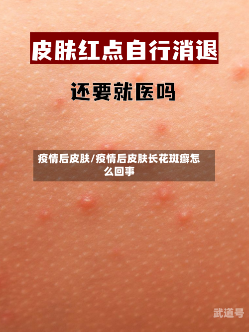 疫情后皮肤/疫情后皮肤长花斑癣怎么回事