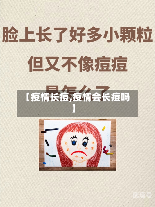 【疫情长痘,疫情会长痘吗】